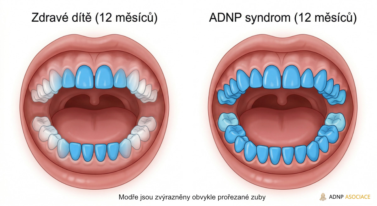 Prořezání zubů u dětí ve 12 měsících