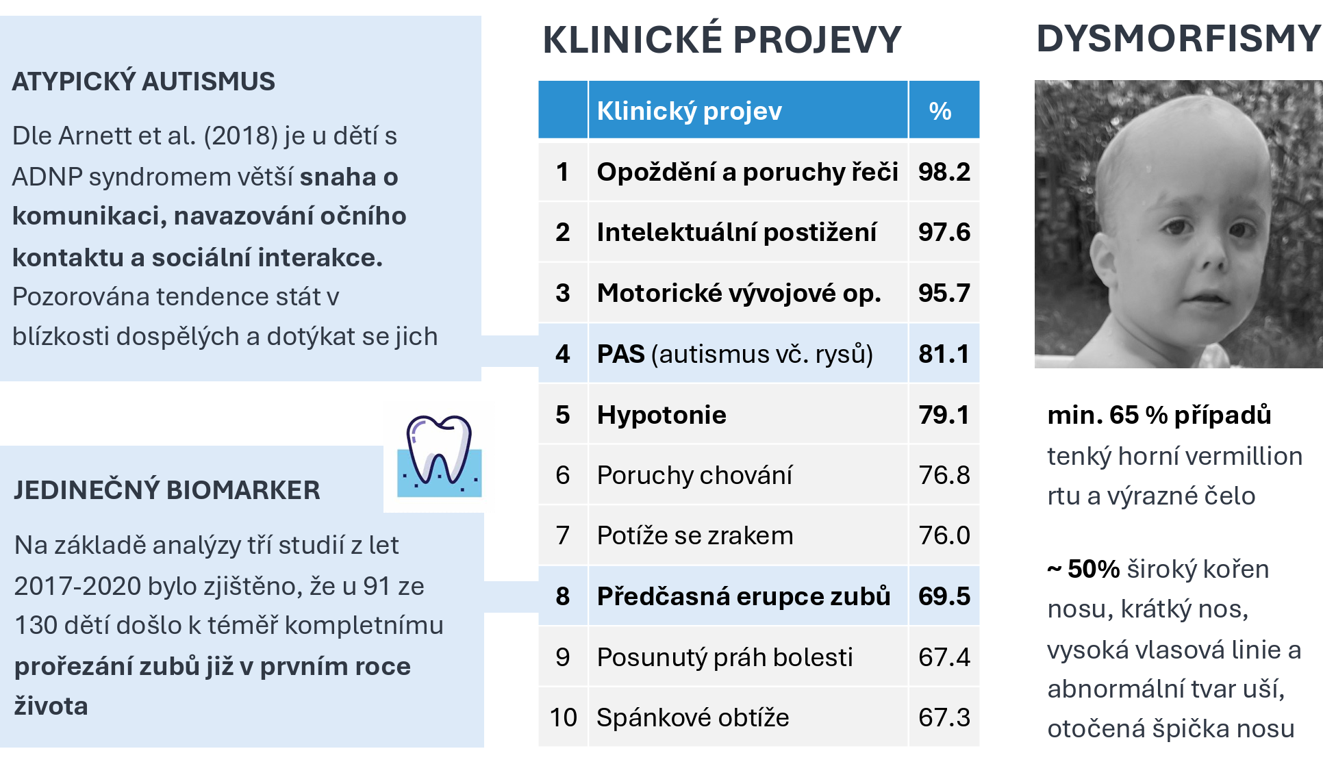 Klinické projevy ADNP syndromu